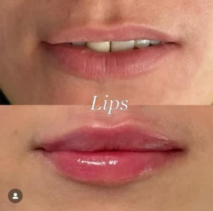 "Lips"